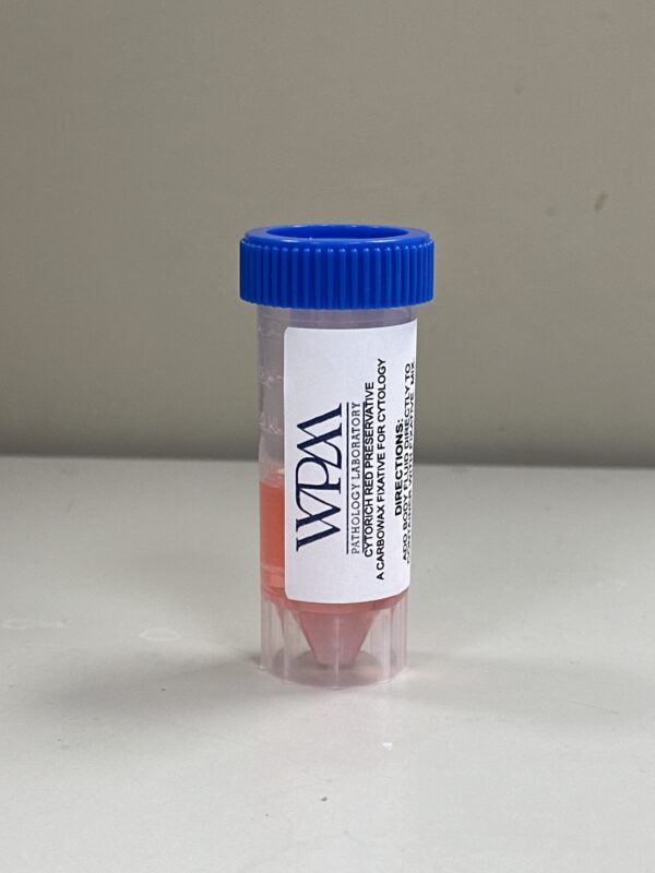 FNA Container (Pre-Filled/CytoRich Red) - Singles