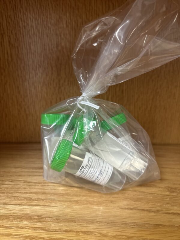 Urology-Prostate Biopsies ONLY (6 pack)