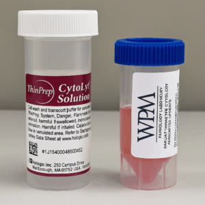FNA Container (Pre-Filled/CytoRich Red) (Replaces CytoLyt) - Singles